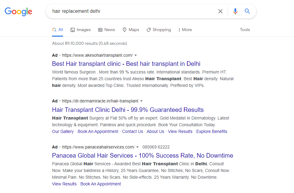 Google Ads For Hair Transplant