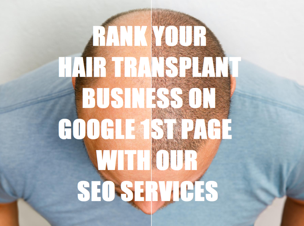 SEO For Hair Transplant